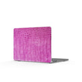Tina- MacBook Case